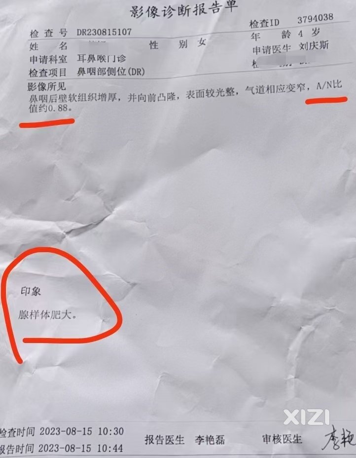 科普一下腺样体肥大A/N比值标准