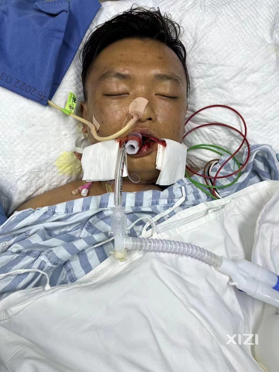 【惠州血库中心O血型告急急需O型血】