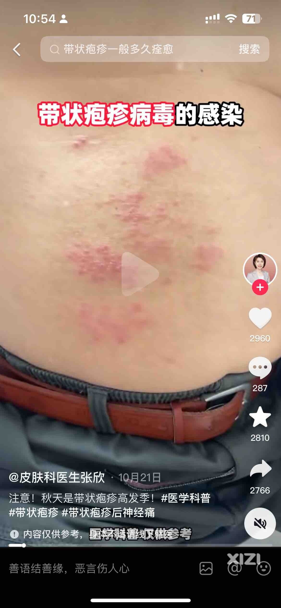 要去打预防生蛇的疫苗吗？