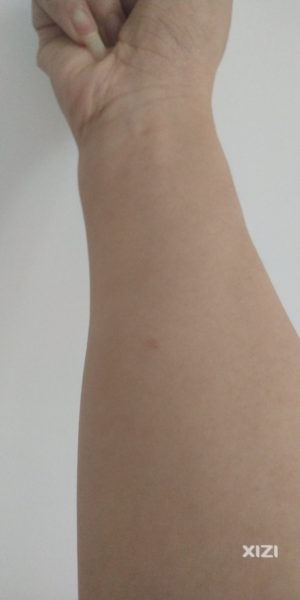 皮肤突然很痒，是蚊子变异了吗？