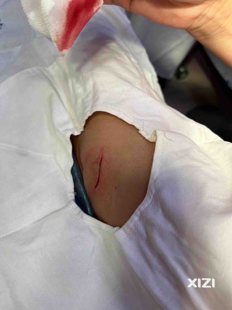 龙丰市场居有危险“暗器” 负责人态度却极其恶略