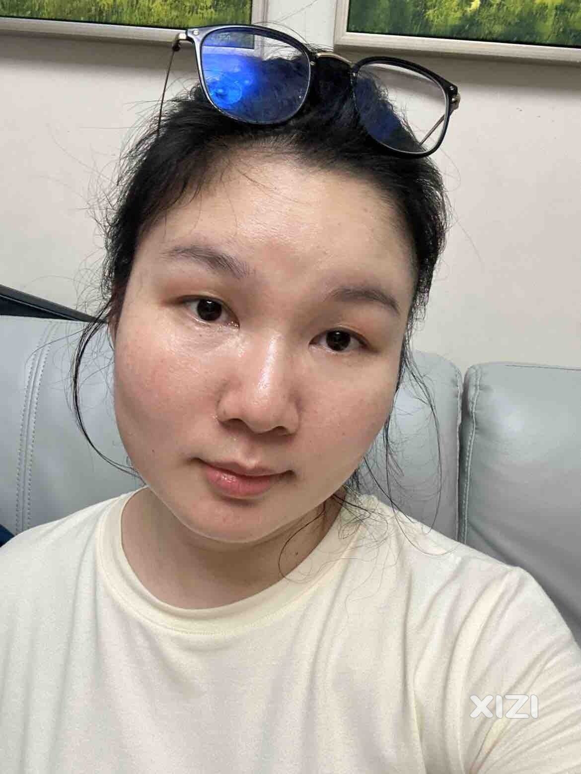 哈哈哈，今天去看医生