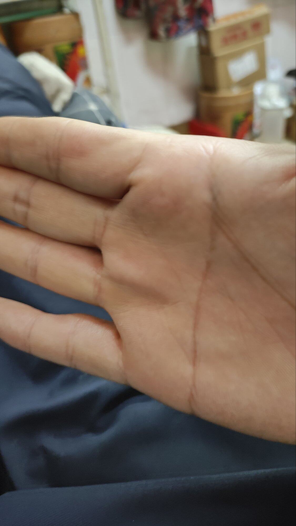 我右手是断掌，这很奇怪吗？