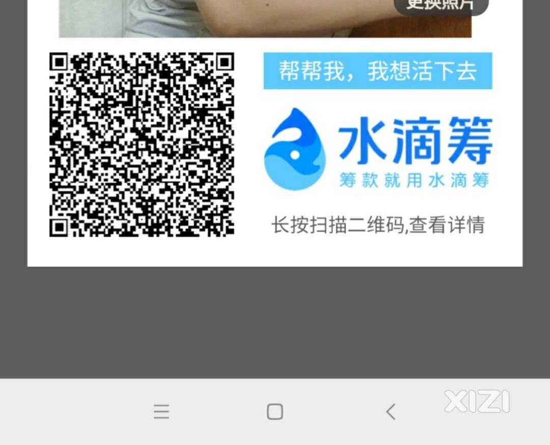 我父亲脑梗需要大家帮助援手