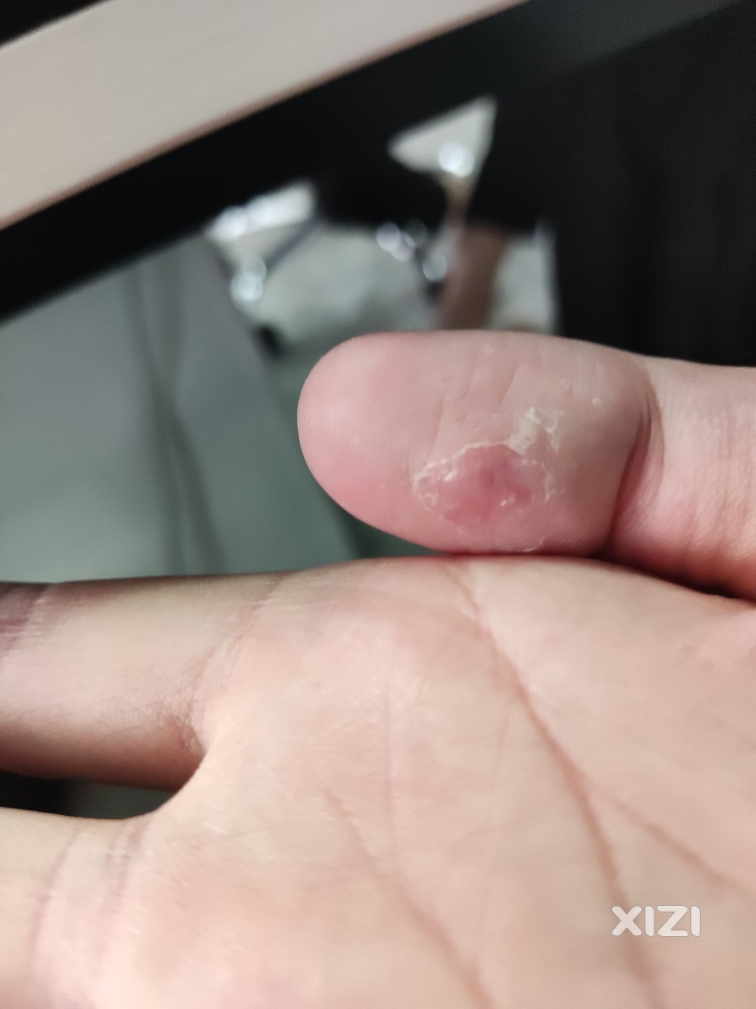 惠州那个皮肤医院好？
