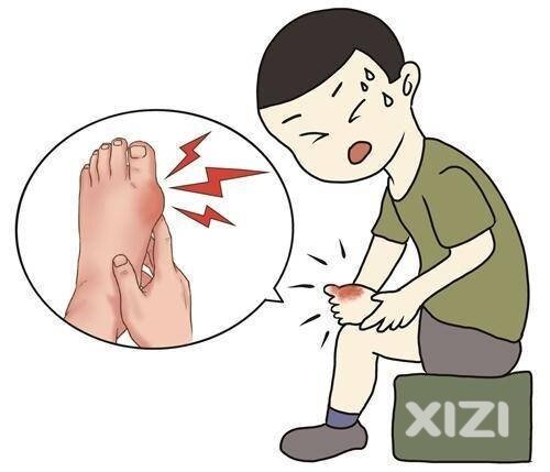 30 痛风 风寒湿痹型 中医外治法分享