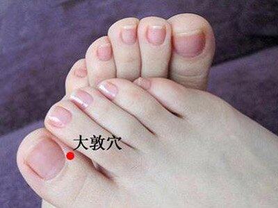 32 痛风 痰瘀阻滞型 外治法分享