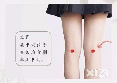 35 痛风 寒热错杂型  中医外治法分享