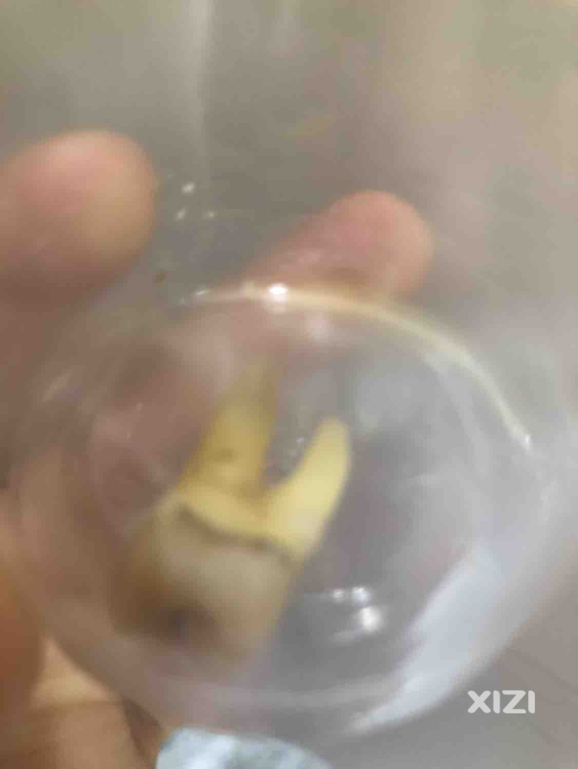 终于铲除了可恶的智齿