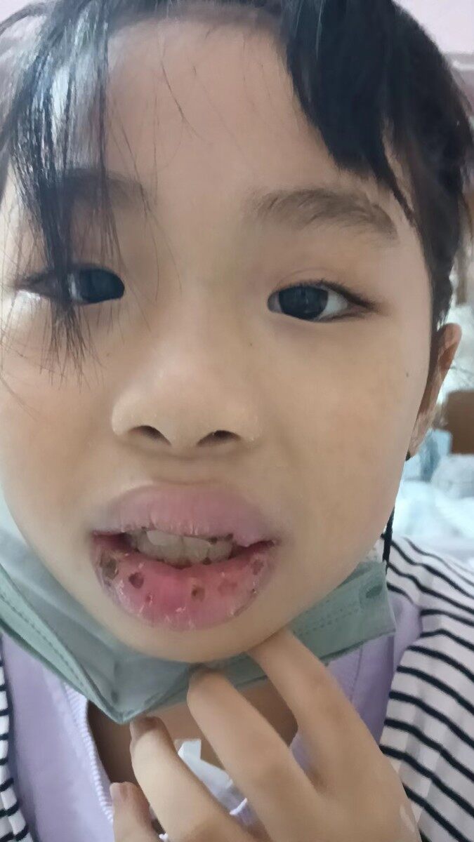 ”妈妈该怎么救你“！！！一个9岁得了急性白血病小女孩母亲的呐喊！