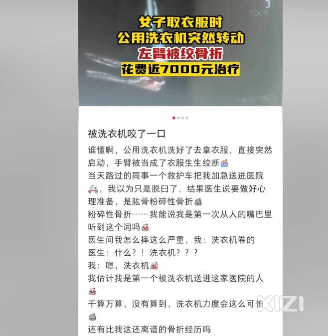 手被洗衣机给绞了