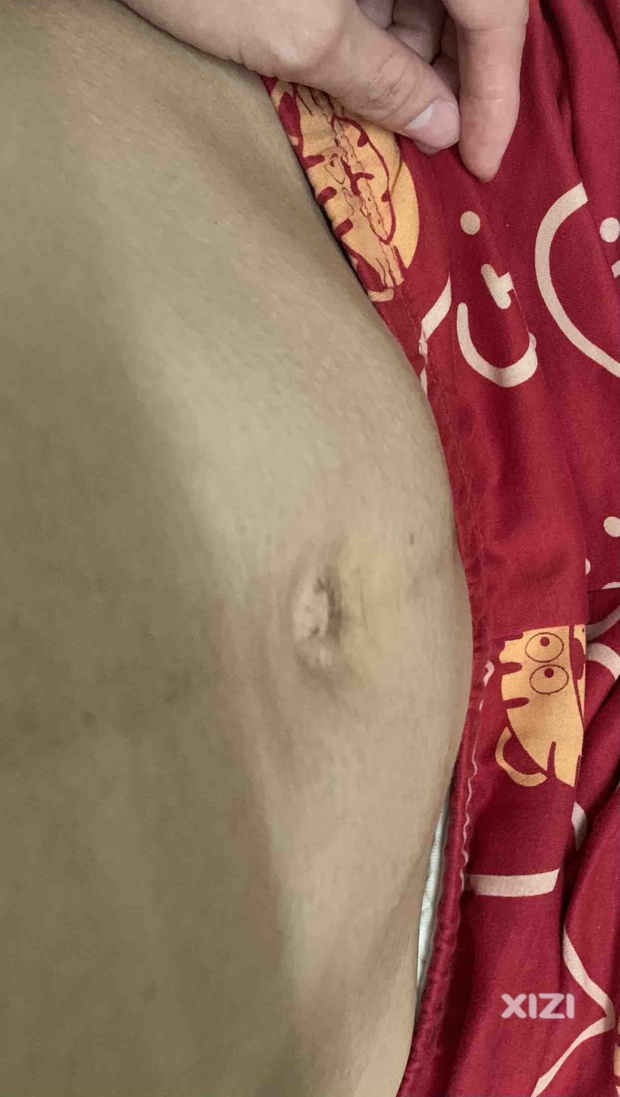 生完孩子后的肚子，真是一言难尽