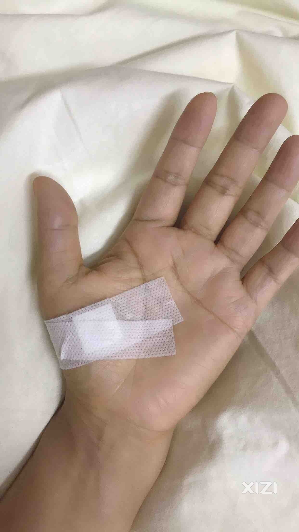左母指腱鞘炎小针刀手术，今天上午十点多做的