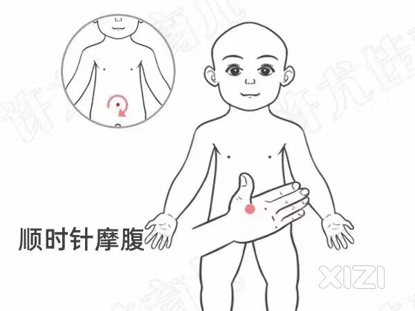 小儿便秘