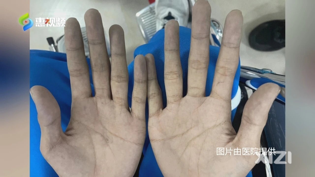 谨防暑期意外伤害事件！12岁少年误服亚硝酸盐致病情危重