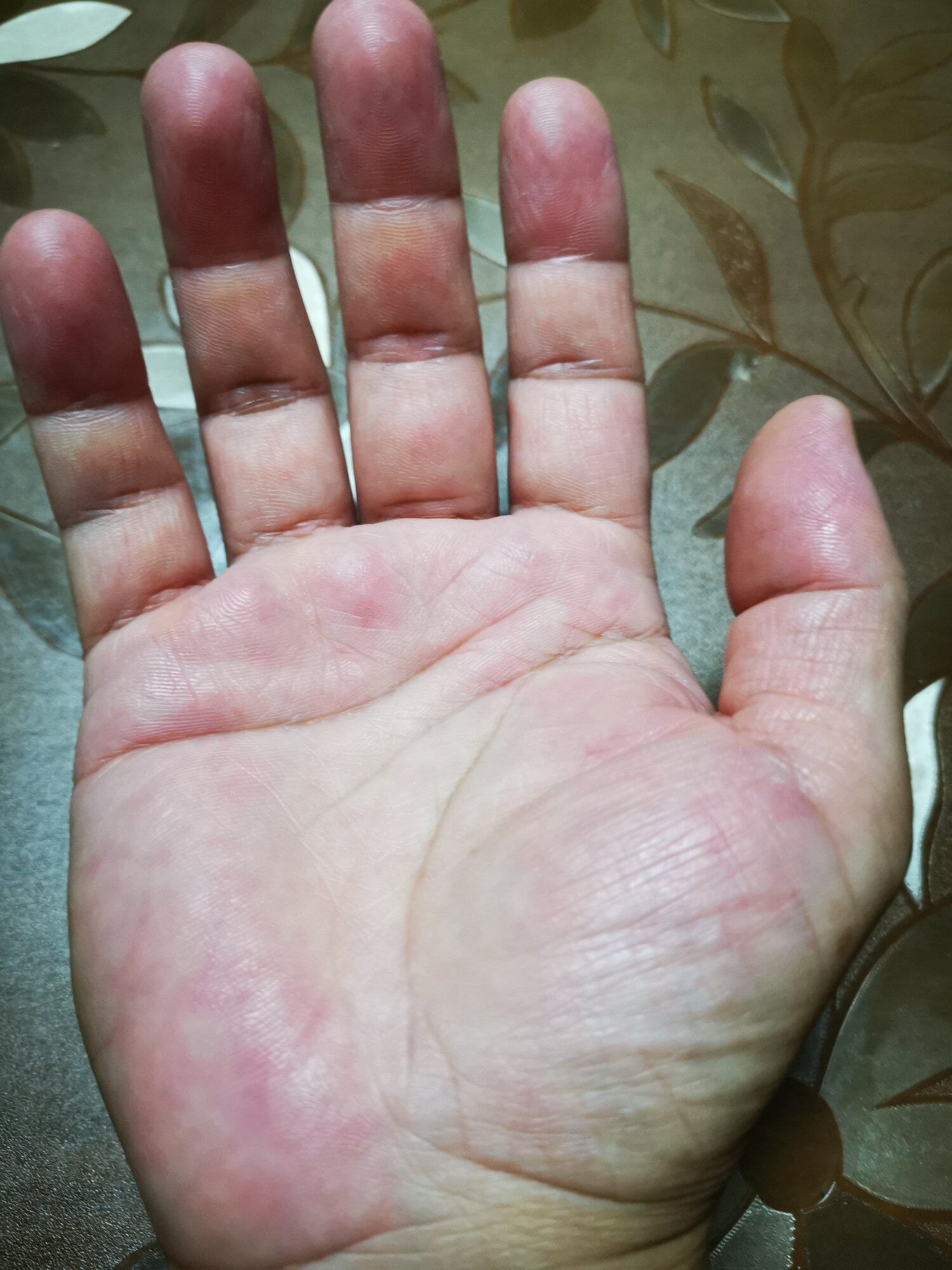 这手指真的很短！