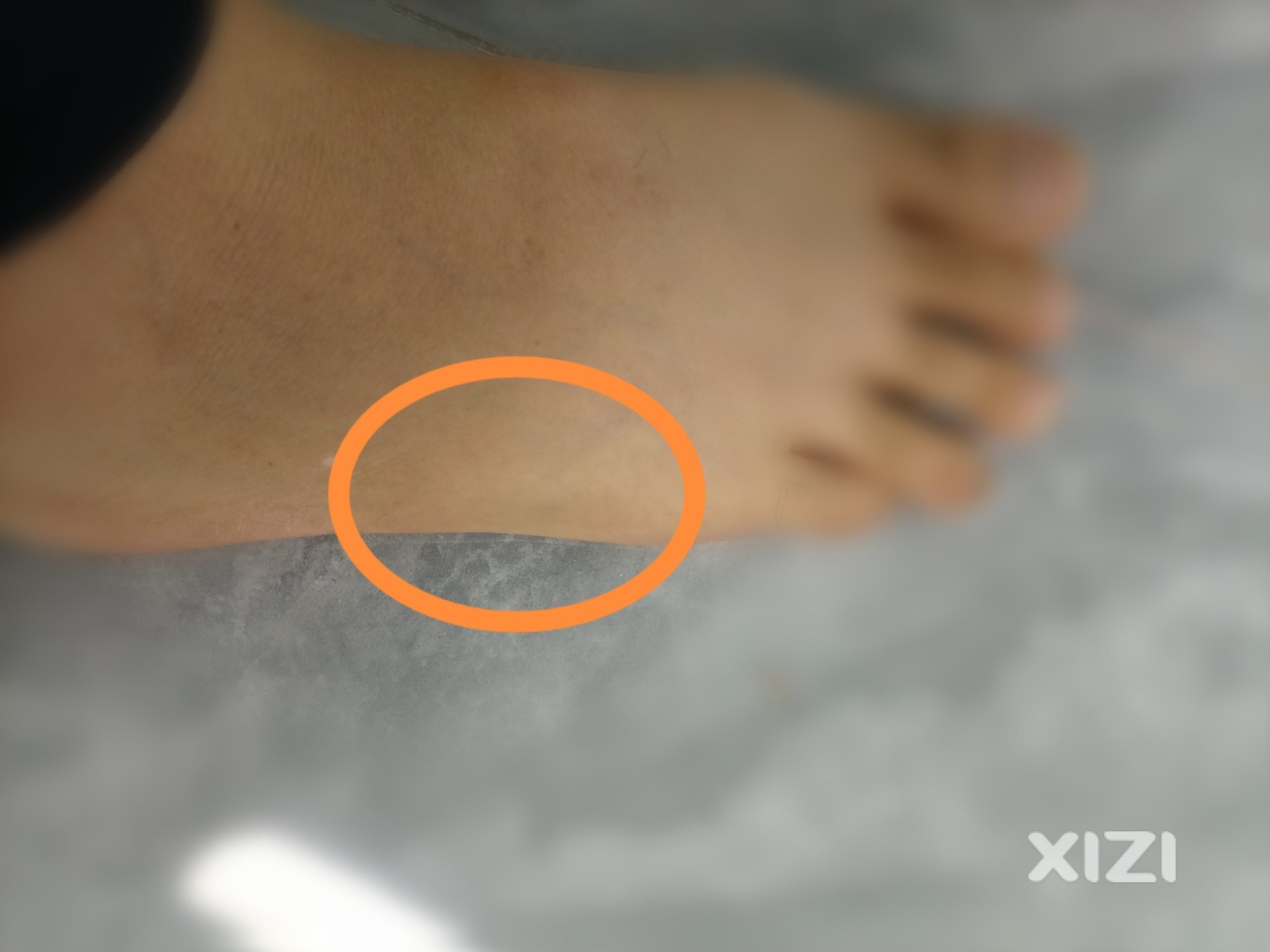 崴脚哪里看，有没推荐