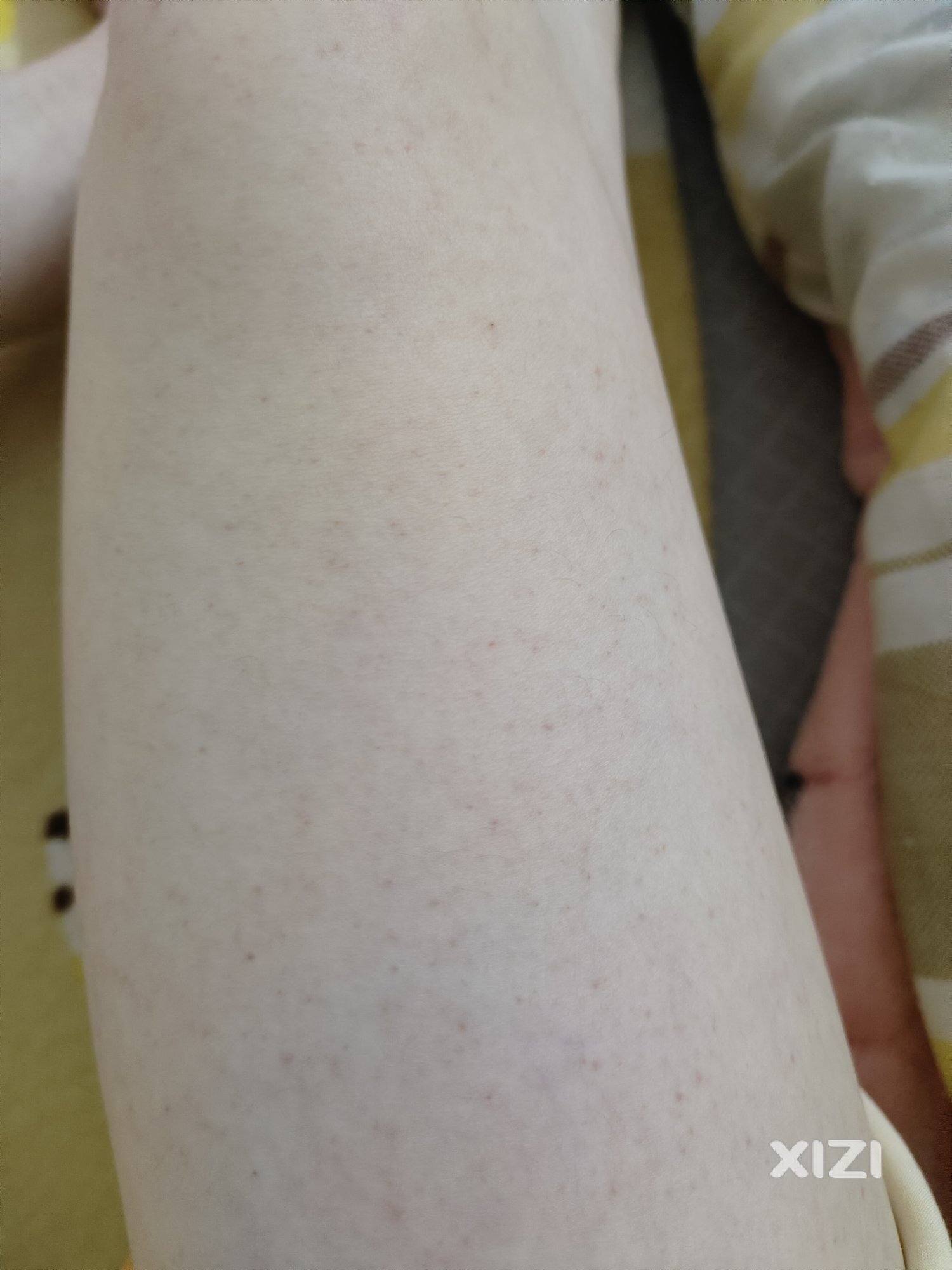 西柚们  腿上这几天